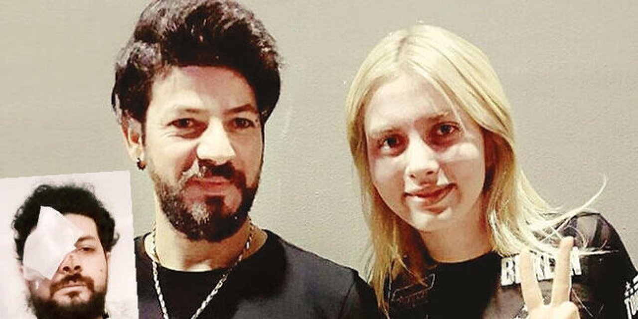 Maganda kabusu... Genç müzisyen gözünü kaybetti!