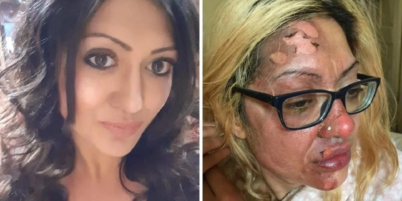 Mikrodalgada yumurta pişirmek istedi, sonu kötü bitti