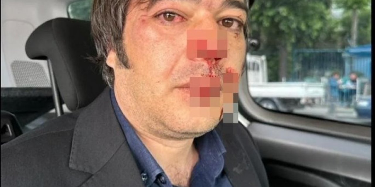 İBB'nin Üsküdar’da kaçak kafe yıkımı: Arbede çıktı... İBB İmar Müdürü Ramazan Gülten darbedildi