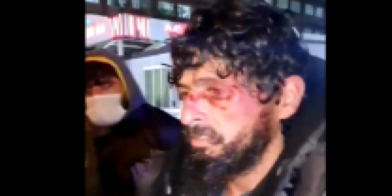 Vicdan sızlatan iddia...  Hastane güvenliği evsiz adamı öldüresiye dövdü!