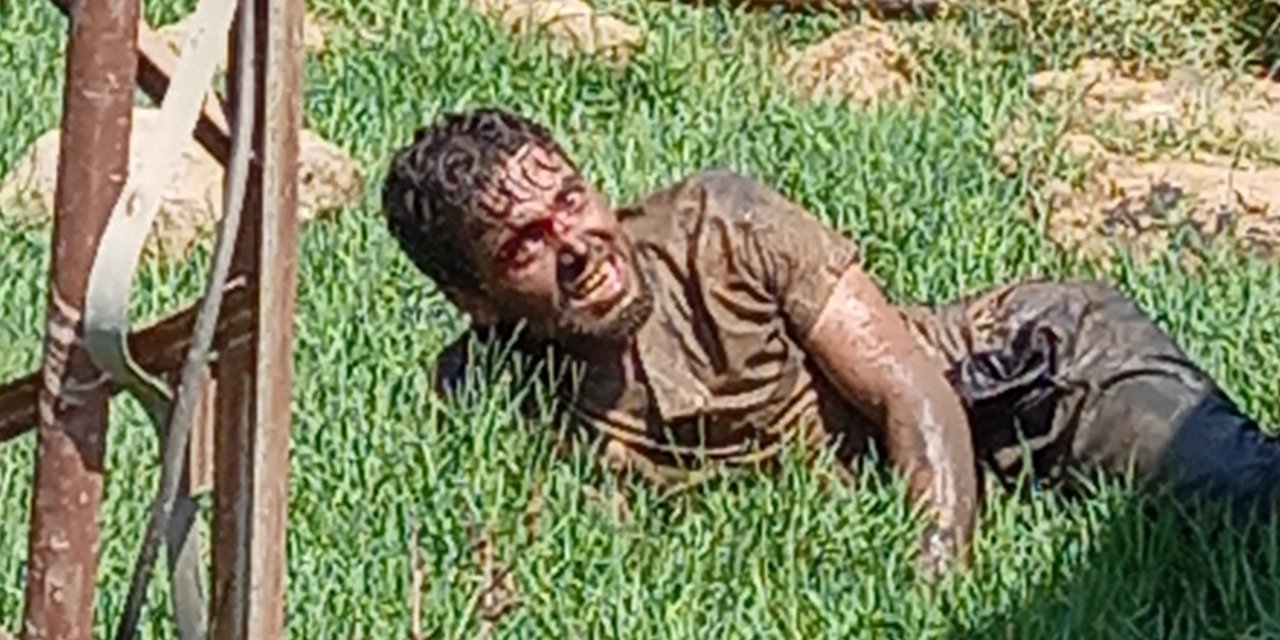 Şanlıurfa'da kuduz hastası hastaneden kaçtı, vatandaşlar paniğe kapıldı