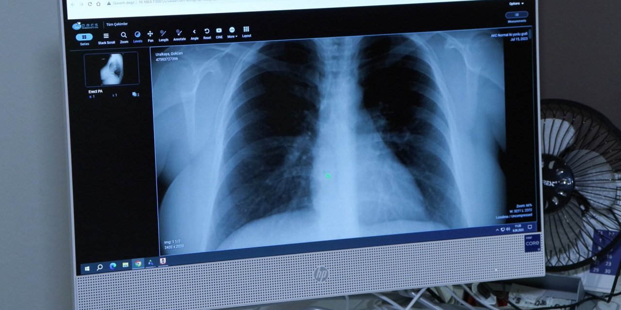 “Afrika sıcaklarıyla akciğer ve alerji hastalıkları da arttı”... Nasıl önlem alınmalı?