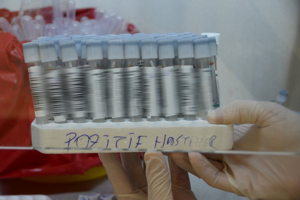 Bu laboratuvarda koronavirüs testi sonuçlarının kesinlik oranı yüzde 100