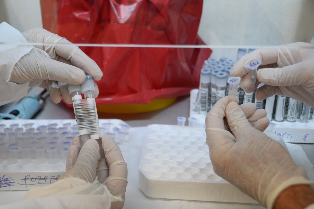 Bu laboratuvarda koronavirüs testi sonuçlarının kesinlik oranı yüzde 100