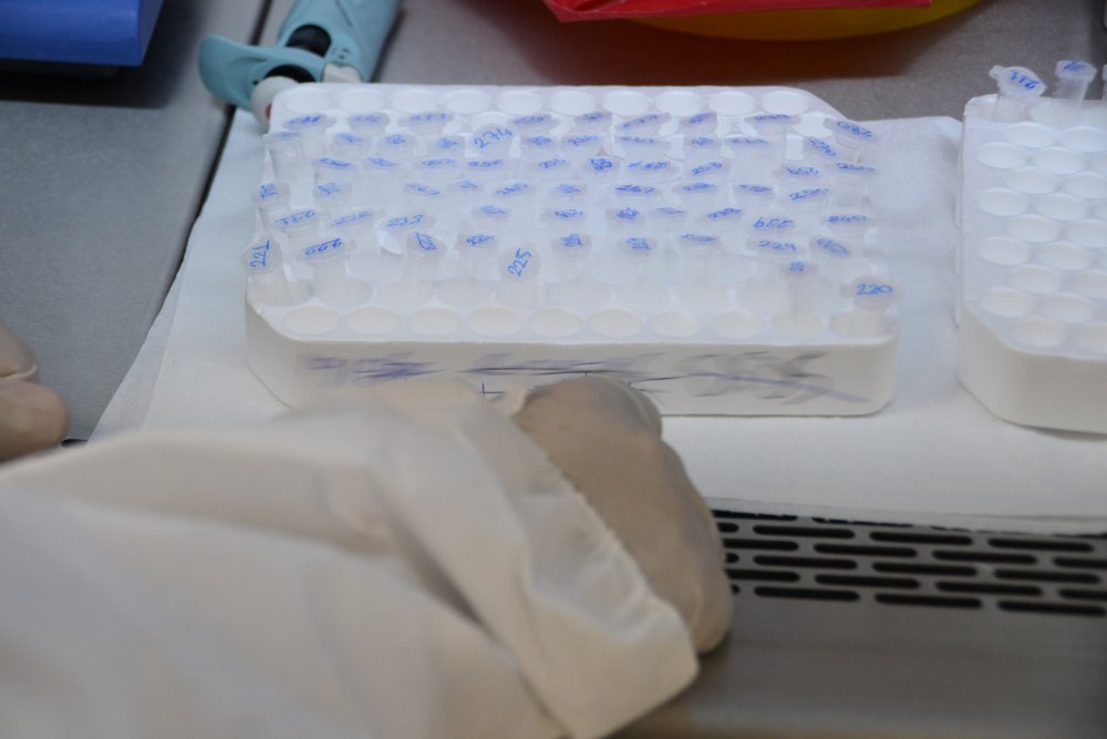 Bu laboratuvarda koronavirüs testi sonuçlarının kesinlik oranı yüzde 100