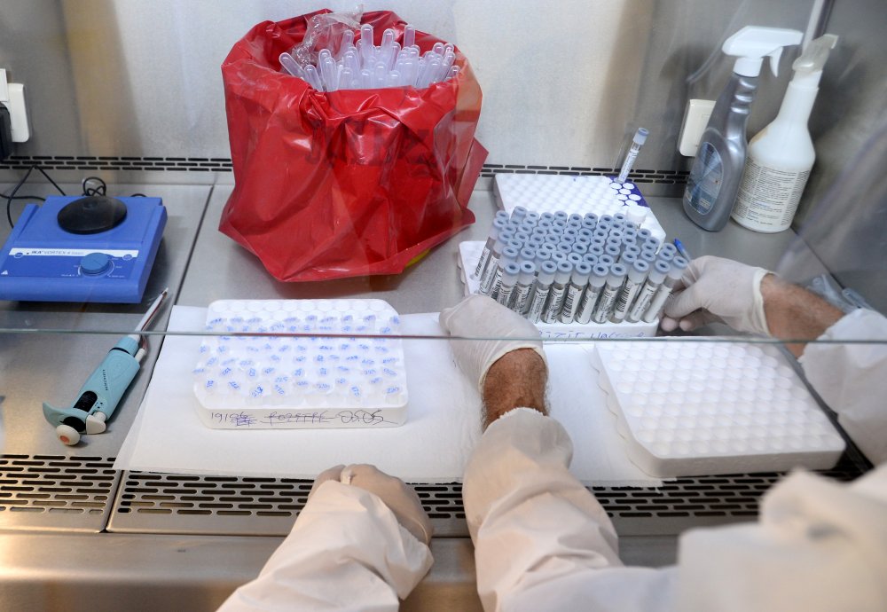 Bu laboratuvarda koronavirüs testi sonuçlarının kesinlik oranı yüzde 100
