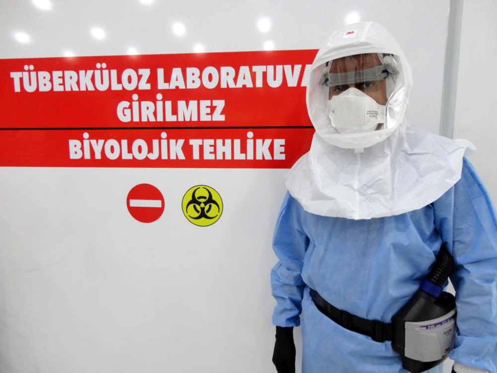 AÜ'den tüberkülozun erken teşhisinde önemli buluş