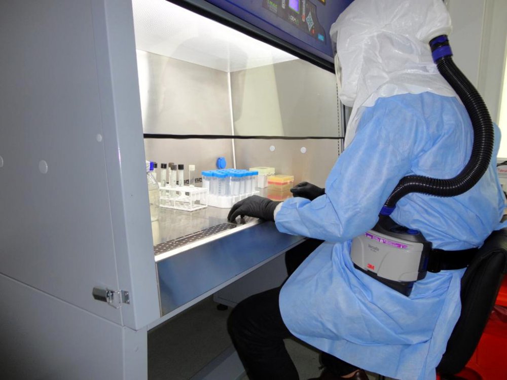 AÜ'den tüberkülozun erken teşhisinde önemli buluş