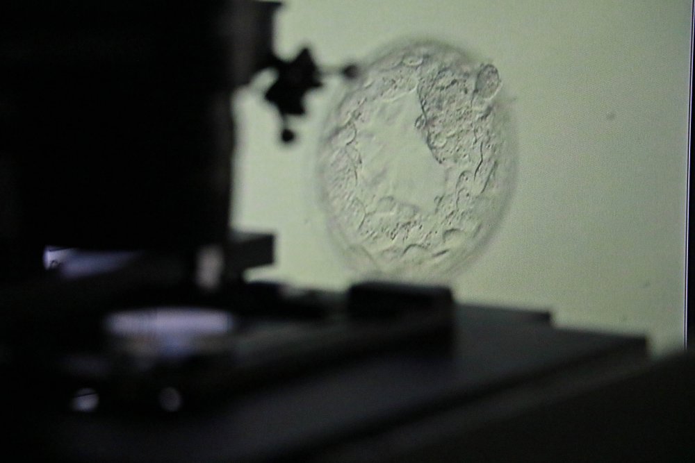 'Dondurma işlemi ile kadınlar, artık istedikleri yaşta anne olabiliyor'