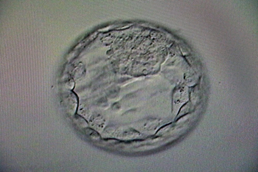 'Dondurma işlemi ile kadınlar, artık istedikleri yaşta anne olabiliyor'