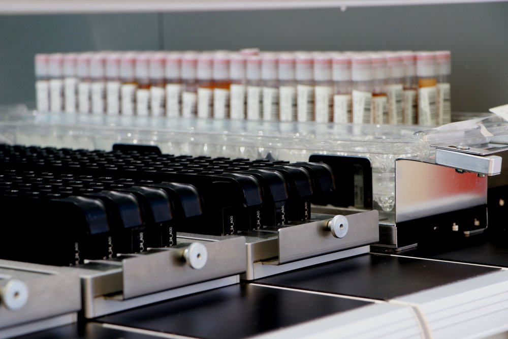Yılda 600 bin ünite kan bu kanlaboratuvarda işleniyor
