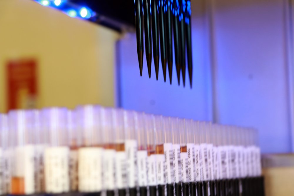 Yılda 600 bin ünite kan bu kanlaboratuvarda işleniyor