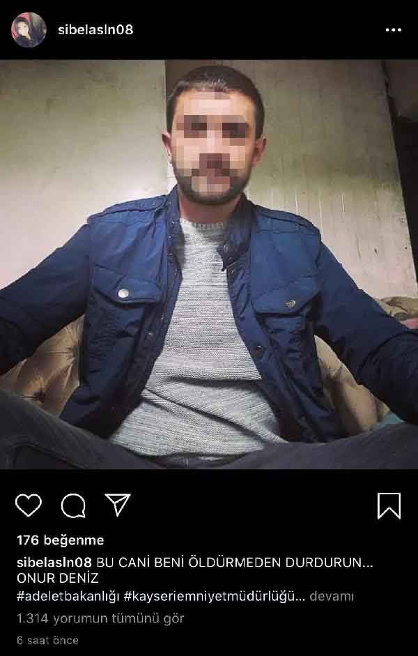 Boşandığı eşinden şiddet gören Sibel, sosyal medyadan yardım istedi