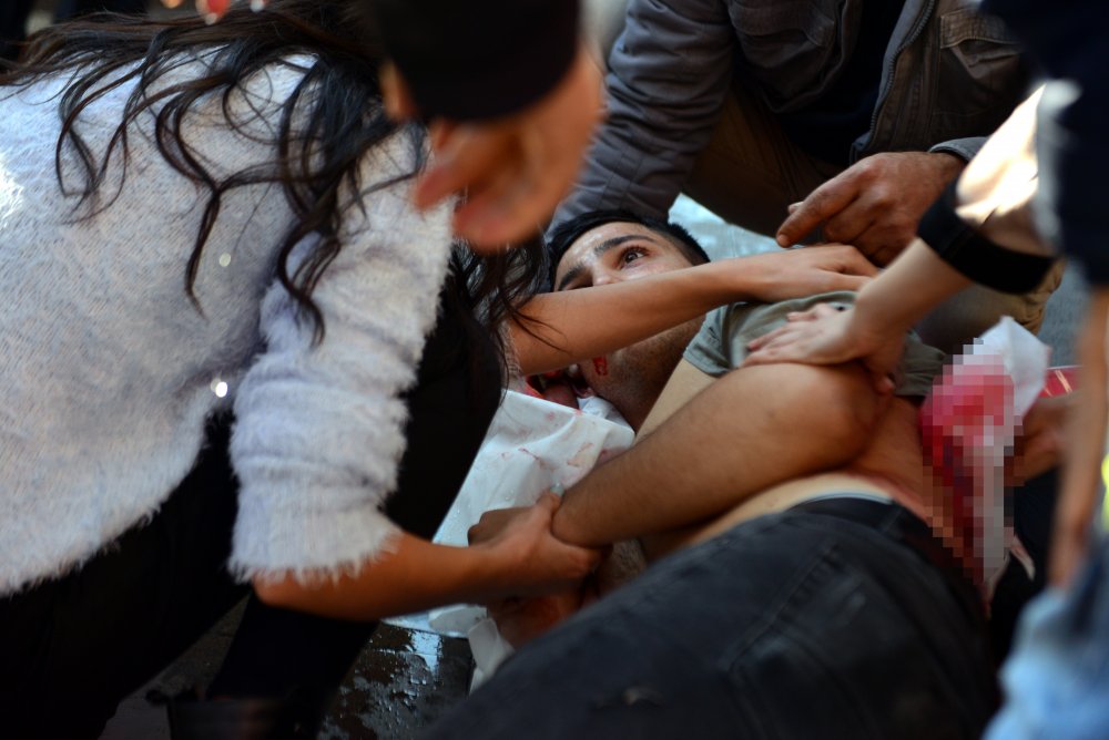 İki kardeş kavgada yaralandı, ilk müdahaleyi bölgeden geçen sağlıkçılar yaptı