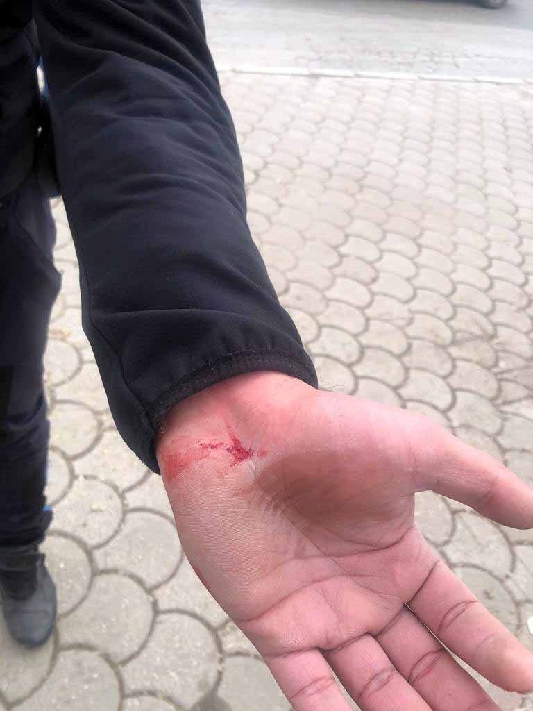 Gaziantep'te zabıtalara bıçak ve sopalı saldırı: 2 yaralı