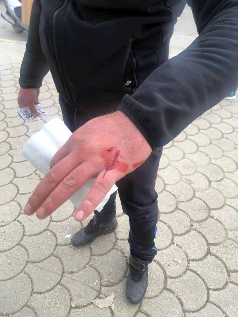 Gaziantep'te zabıtalara bıçak ve sopalı saldırı: 2 yaralı