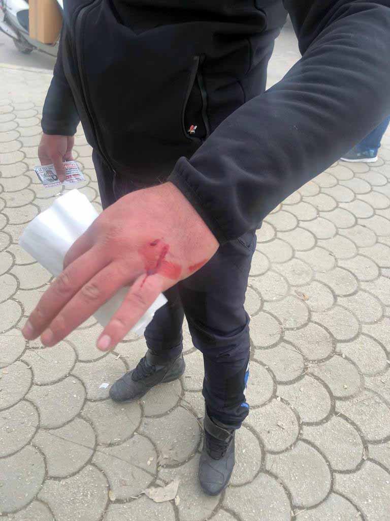 Gaziantep'te zabıtalara bıçak ve sopalı saldırı: 2 yaralı