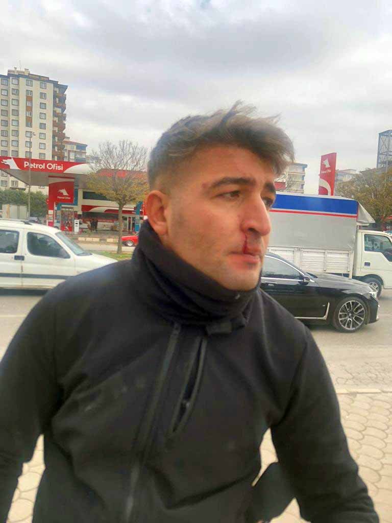 Gaziantep'te zabıtalara bıçak ve sopalı saldırı: 2 yaralı