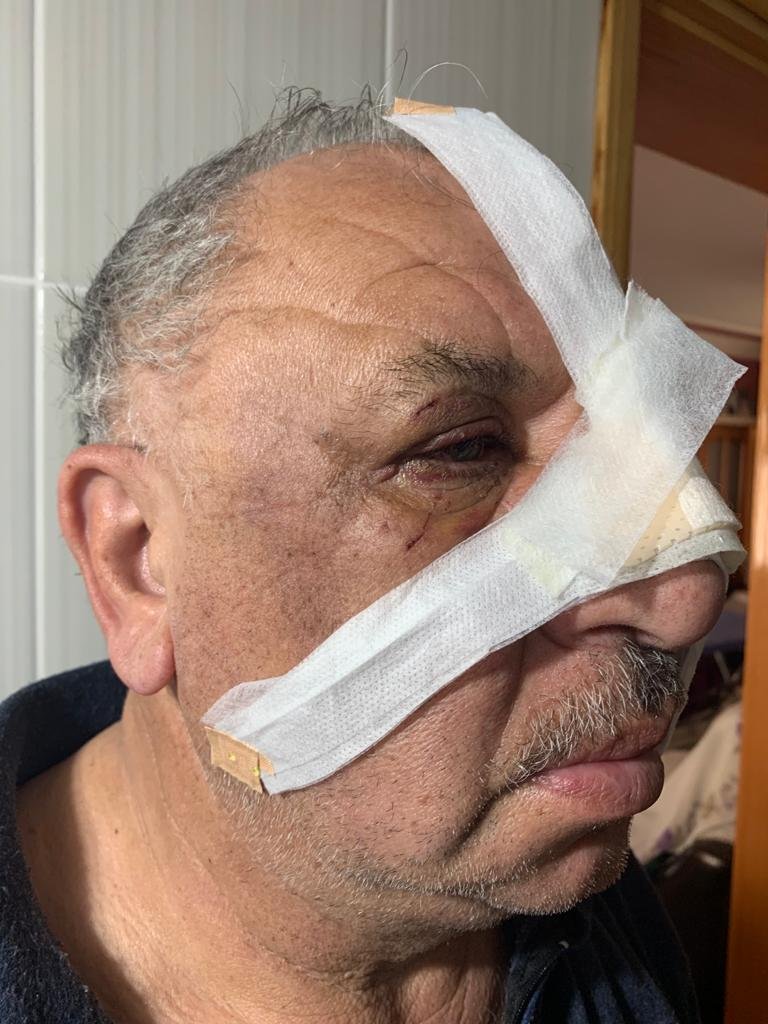 Kazanın ardından kavga kamerada