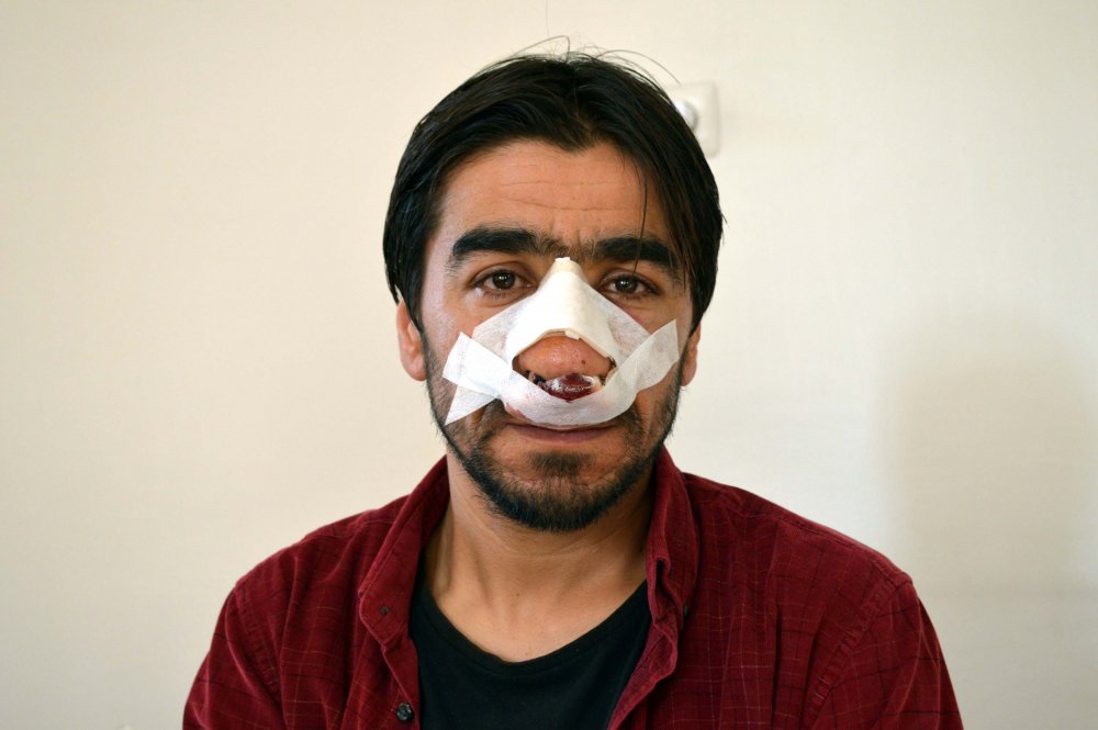 Kömür dağıtan personele saldırı: 2 yaralı, 3 gözaltı