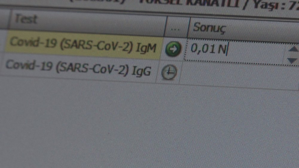 Uzmanından uyarı: Aşı olmak için antikor testi yaptırmaya gerek yok