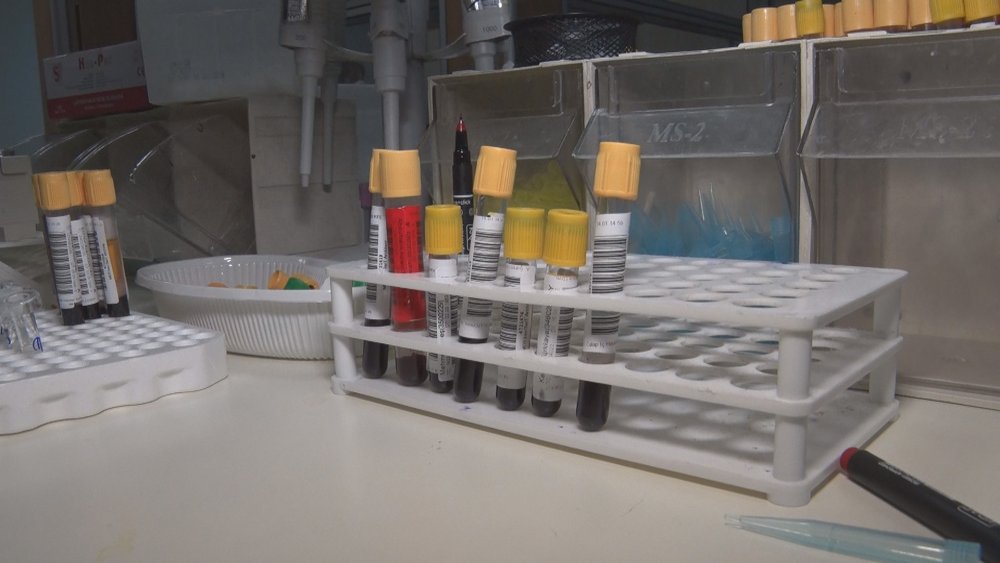 Uzmanından uyarı: Aşı olmak için antikor testi yaptırmaya gerek yok