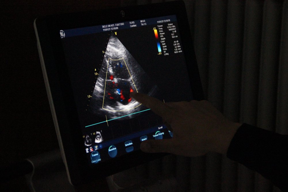 Kasıktaki damardan girilerek kalpte delik açıldı