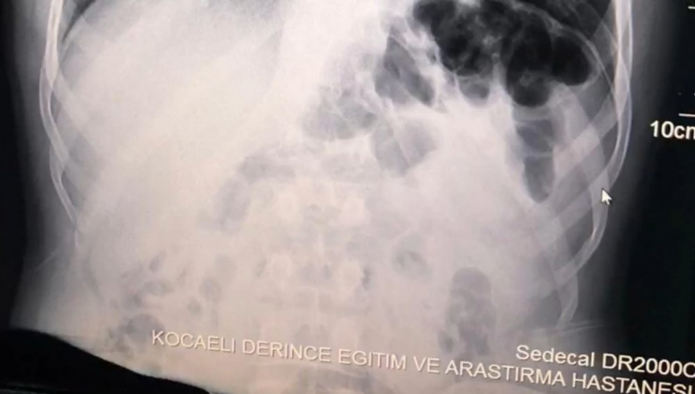 İranlı yolcuların midesinden 871 gram metamfetamin çıktı