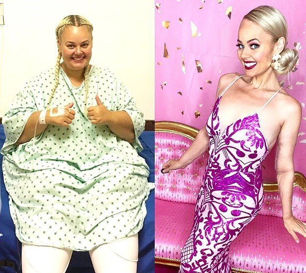 ABD’li sosyal medya fenomeni barbie bebeğe benzemek için 90 kilo verdi