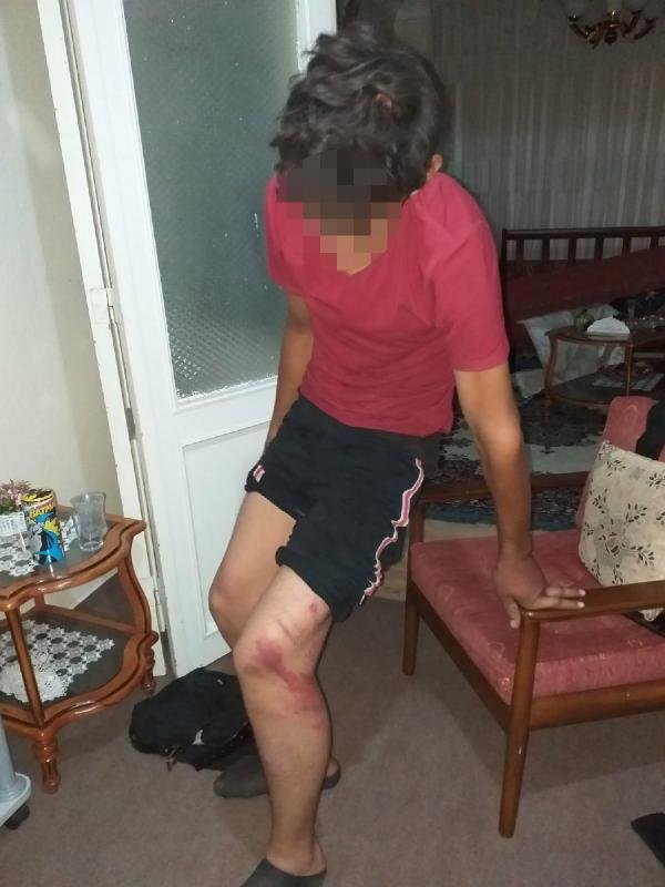Ustanın çırağını dövdüğü triger kayışı, 'silah' sayıldı; indirimle 2 yıl hapis verildi
