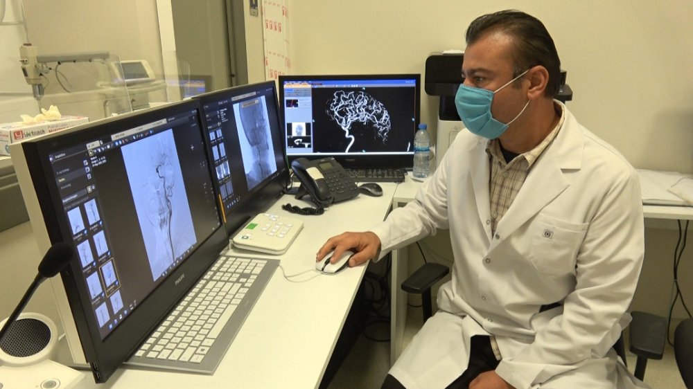 'Koronavirüs hastalarının 3'te 1'inde beyin ve sinir sistemi ciddi şekilde etkileniyor'