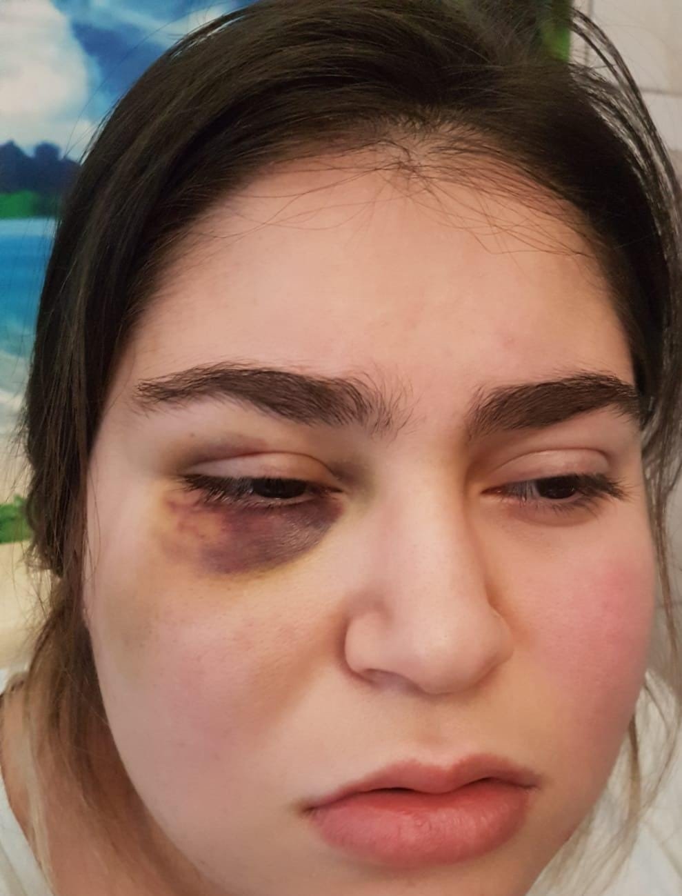 Almanya’da polisin kızıyla birlikte dövdüğü Türk konuştu