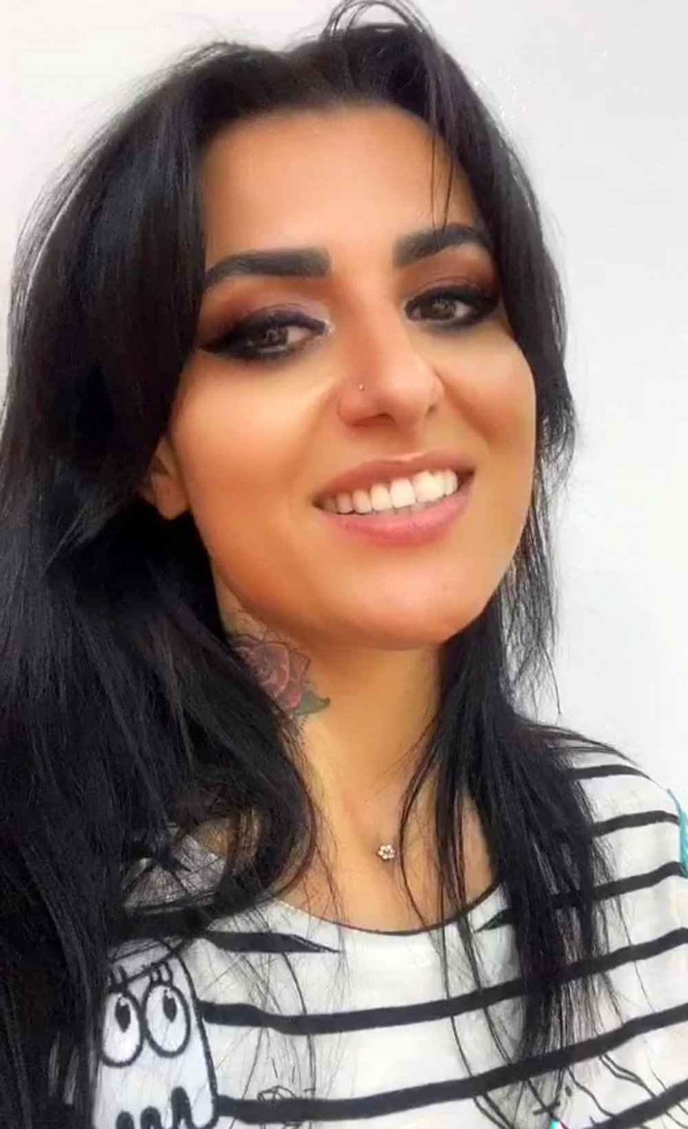 Gittiği güzellik merkezi yüzünü yaktı, tehdit etti