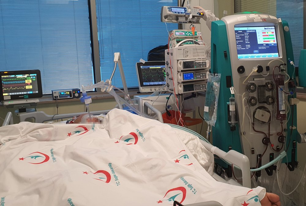 Mis-C vakalarının çoğu farkında olmadan Kovid geçirmiş