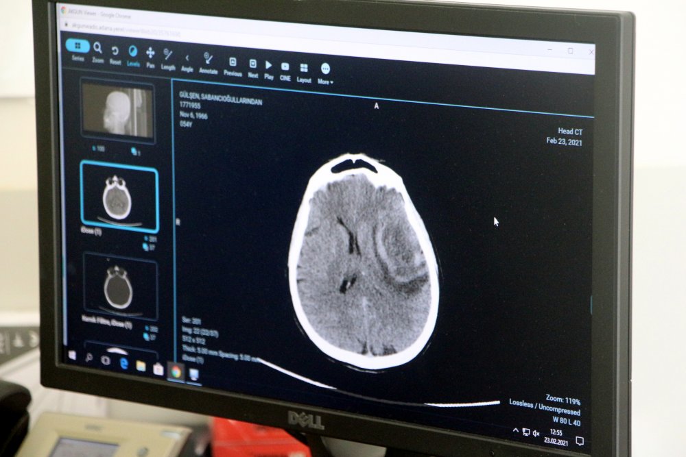 Pandemide baş ağrısı şikayetiyle doktora başvuranların sayısı 2 kat arttı