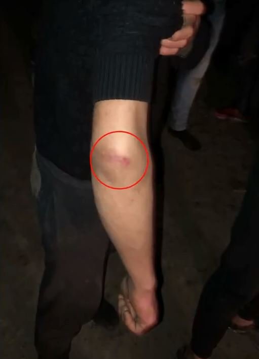 Yunan askerlerinin ölüme terk ettiği göçmenleri, Mehmetçik kurtardı
