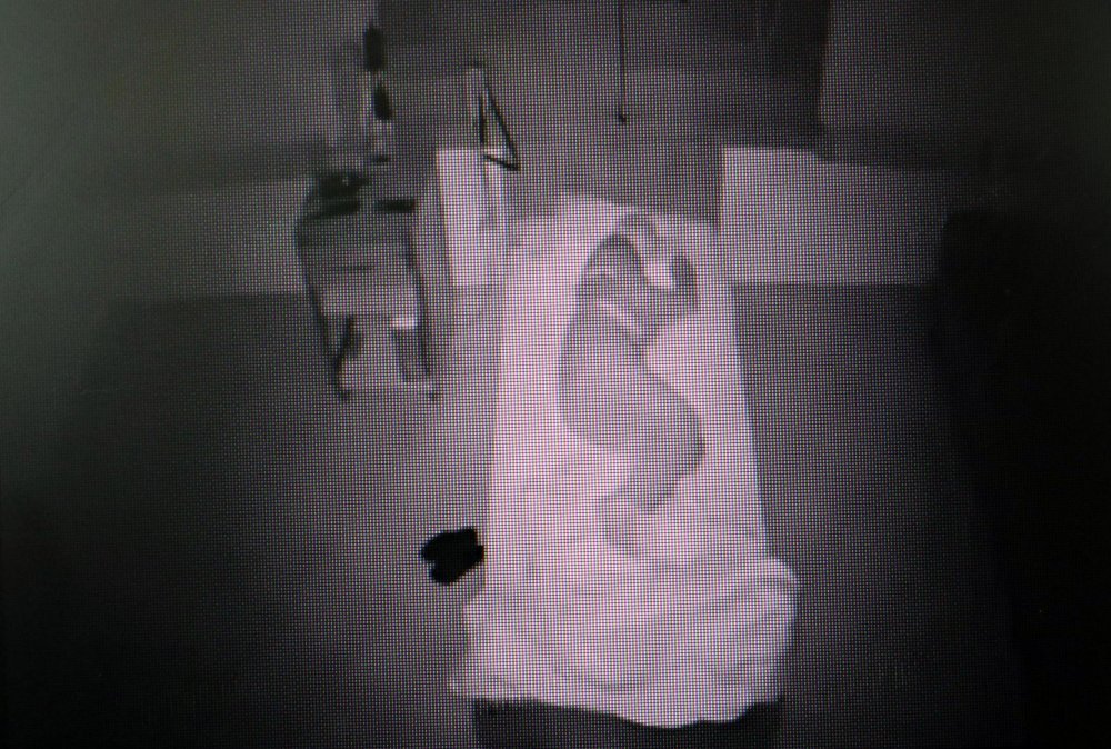 Uyku bozukluğu yaşayanlar, 24 saat kamerayla izlenerek tedavi ediliyor