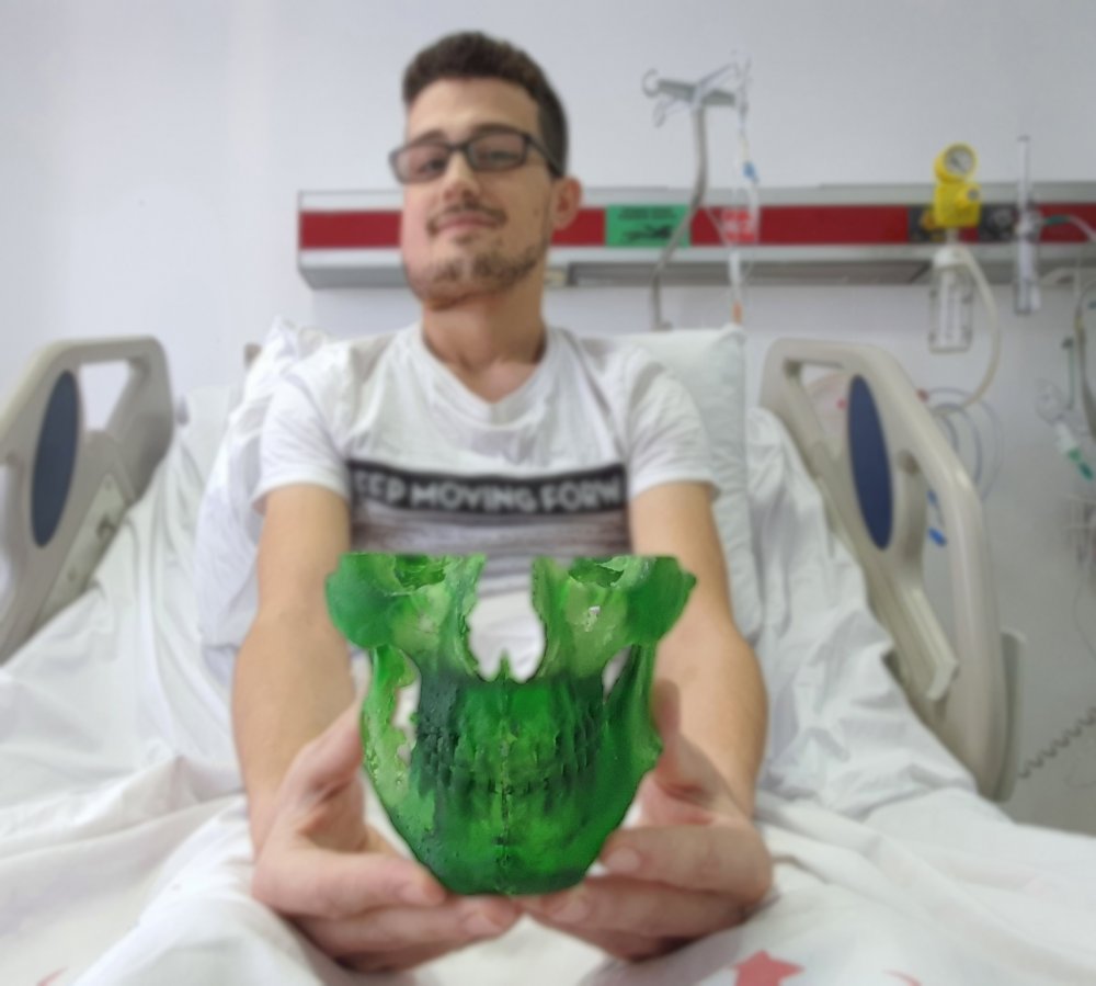 Yüzündeki dev tümörden “sanal ameliyat” ile kurtuldu