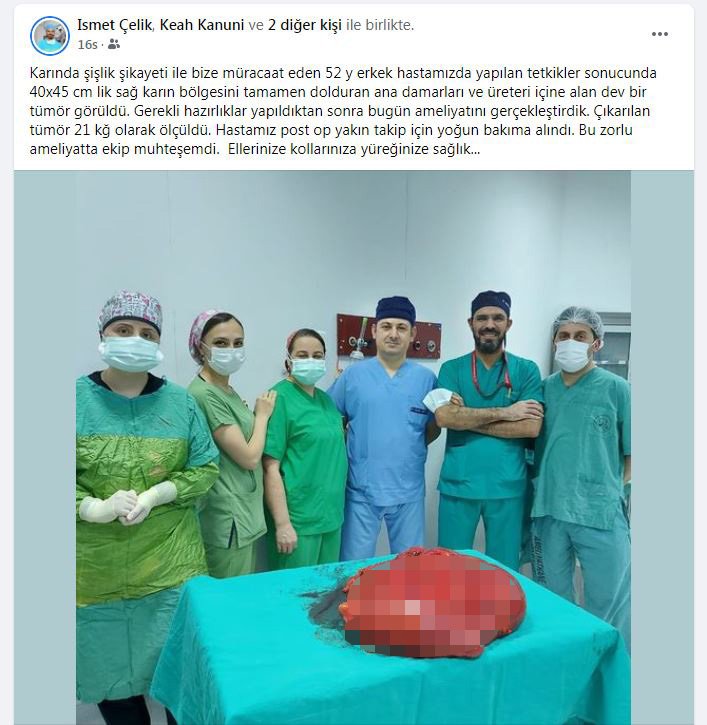 'Gaz' şikayetiyle hastaneye gitti: Karnından 21 kilo tümör çıkarıldı