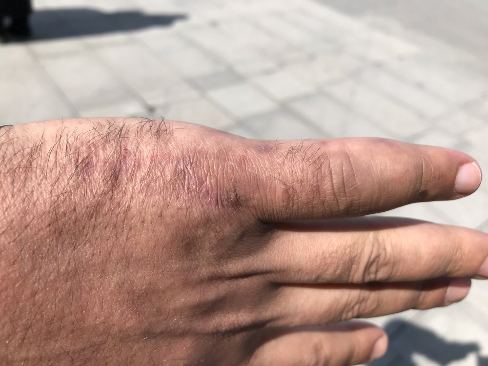 Sağlık çalışanını darp etmişlerdi: 3 kişi hakkında istenen ceza belli oldu
