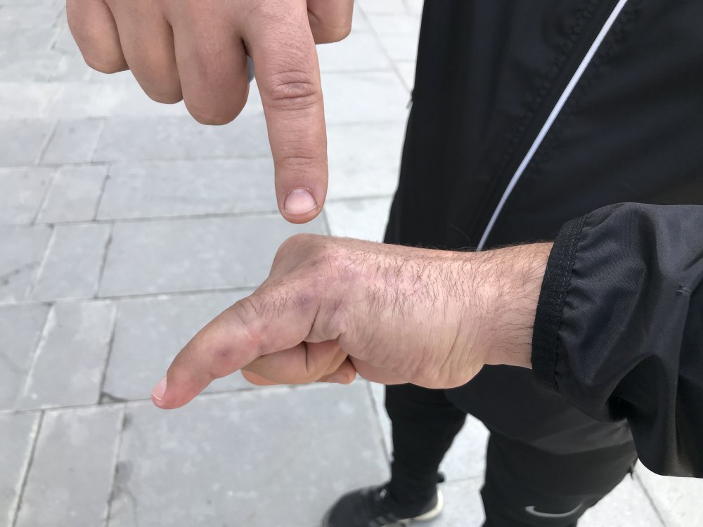 Sağlık çalışanını darp etmişlerdi: 3 kişi hakkında istenen ceza belli oldu