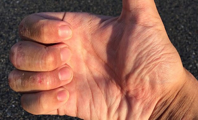 Hava koşullarına dikkat: Cilt sağlığınızı tehdit ediyor olabilir!