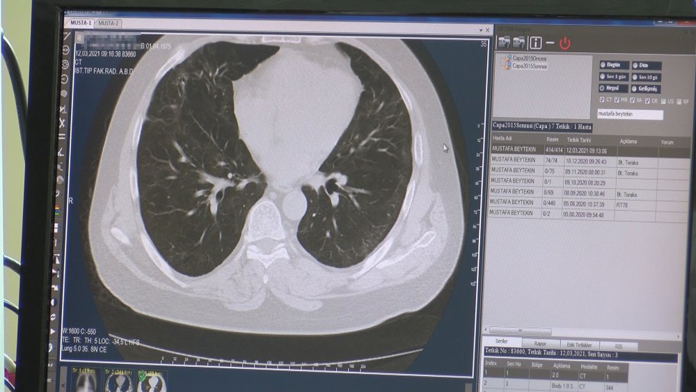 Cerrahpaşa Dekanı Prof. Dr. Gönen'den kritik uyarı: Serbestleşmeyi salgın bitmiş gibi algılamayalım