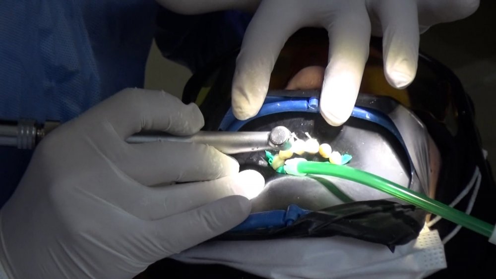 Diş Hekimi Bayraktar'dan önemli uyarı! ‘Pandemi nedeniyle diş tedavilerinizi ihmal etmeyin’