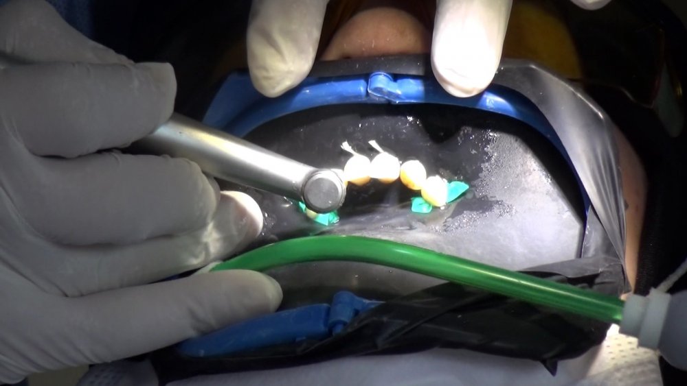 Diş Hekimi Bayraktar'dan önemli uyarı! ‘Pandemi nedeniyle diş tedavilerinizi ihmal etmeyin’