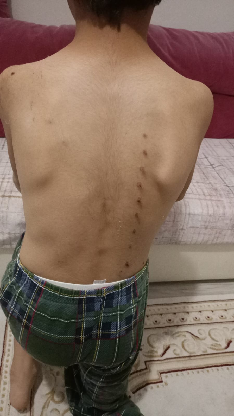 Köpeklerle oynayan 3 çocuğa tırmıkla saldırmıştı... O hemşire hakkında karar verildi!