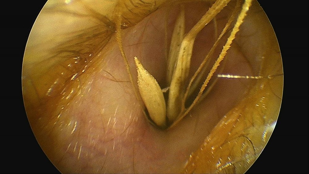 Kulaklardan çıkanlar hayrete düşürüyor