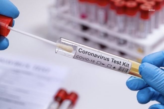 COVİD İÇİN 20 MİLYON VARYANT KİTİ ALINACAK